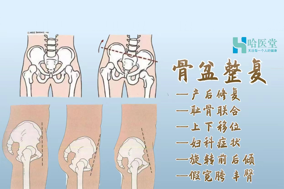 哈尔滨骨盆修复课程