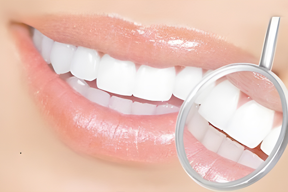 贵阳冰瓷美牙大师班