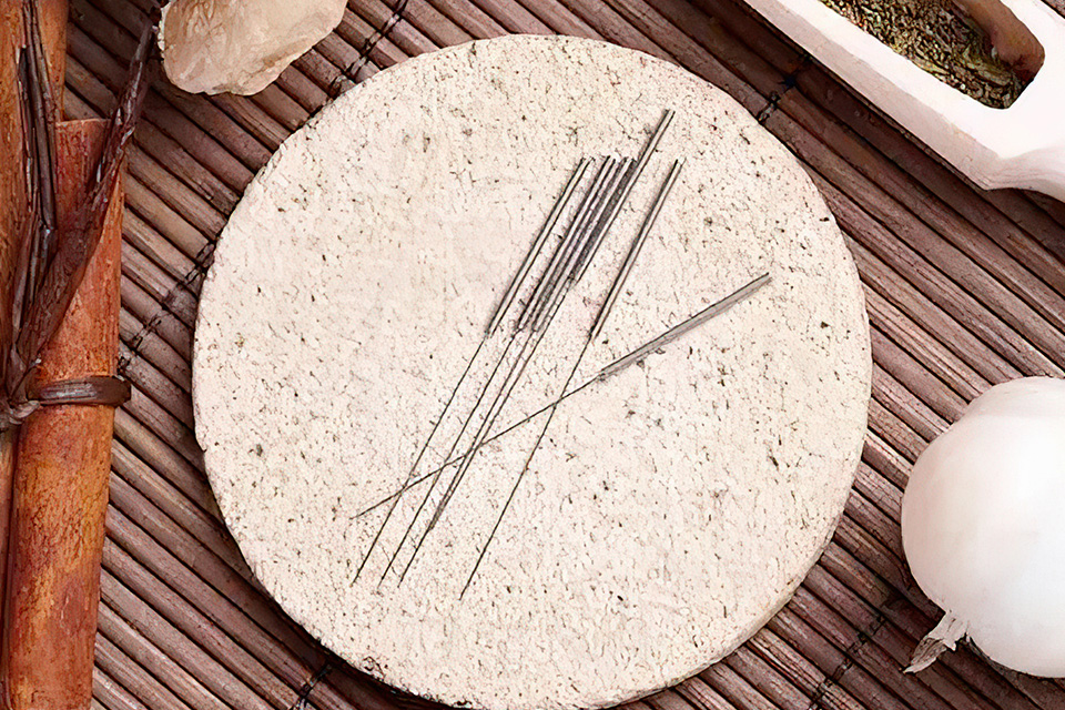 北京中医毫针微创特训班