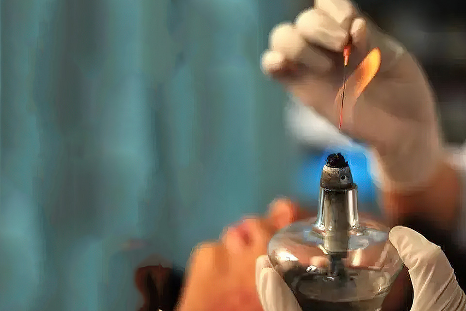 北京火针治疗精品推广班