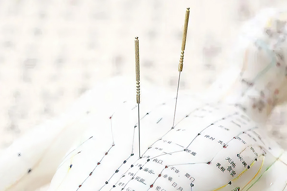 北京徐氏九宫针临床技术